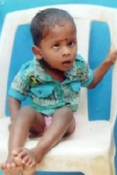 ASHOK - Child supported by UL Lawyers charity program